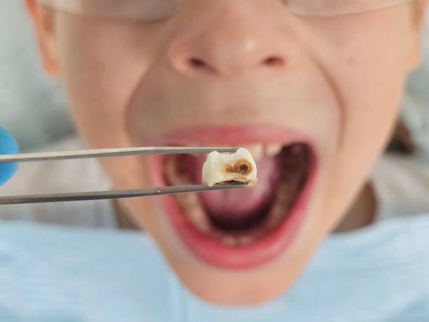 Best Tooth Pain Emergency Relief  in Clifton Gardens, NY